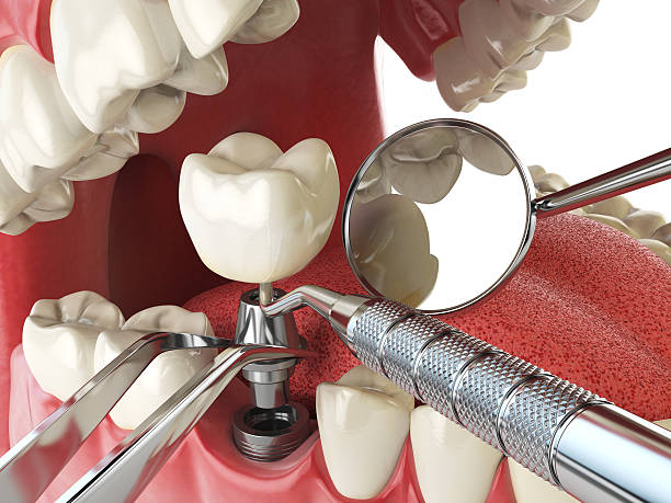 Best Urgent Tooth Repair  in Sansom Park, TX